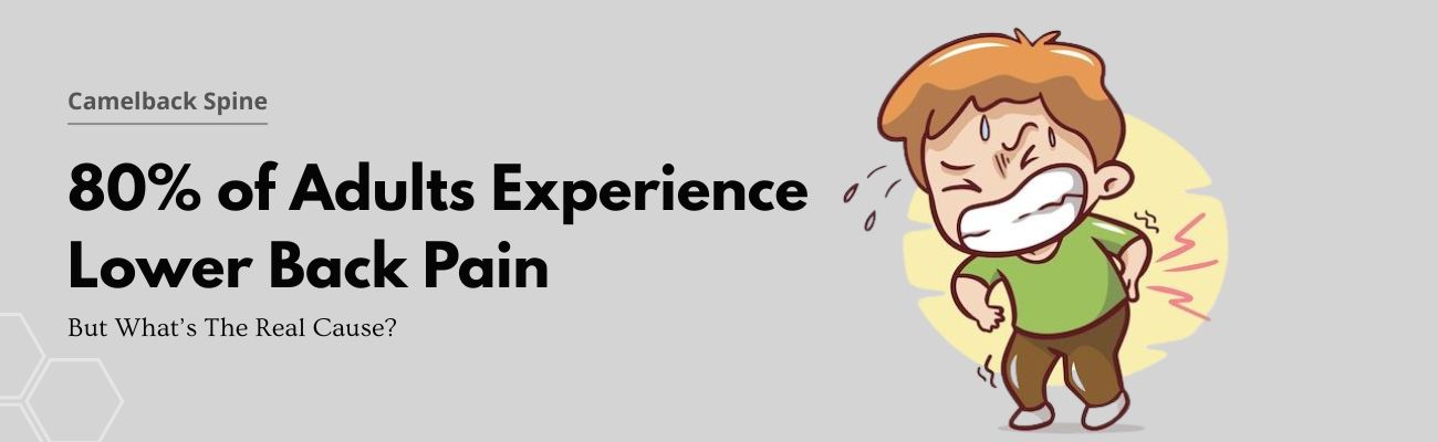 What Are the Real Causes of Lower Back Pain?