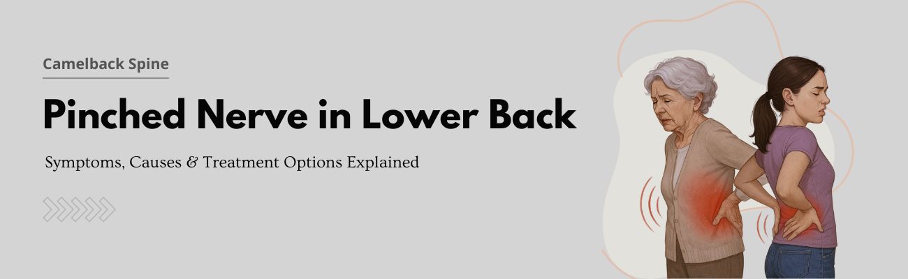 Symptoms of Pinched Nerve in Lower Back and Treatment