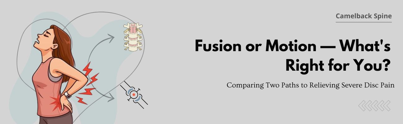 Spinal Fusion vs. Artificial Disc Replacement: Which Surgery Is Right for Your?