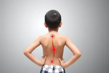 Can Scoliosis Be Prevented?